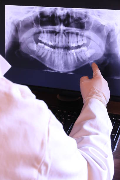 Best Emergency Broken Tooth Repair in Mission, OR